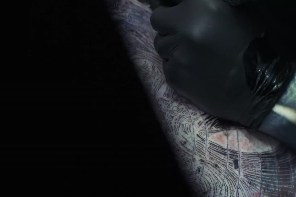 Gloved hands over stretched skin